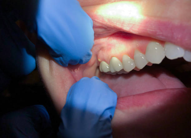 Best Cracked Tooth Emergency Dentist  in Ingram, TX